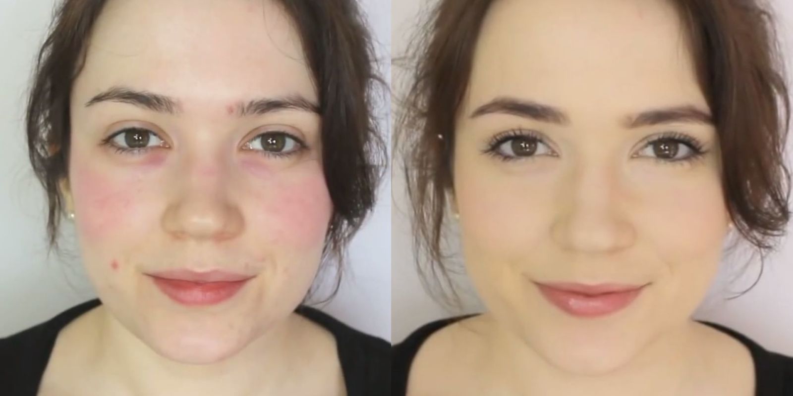 How to Cover Up Rosacea - Makeup Tutorial for Concealing Redness