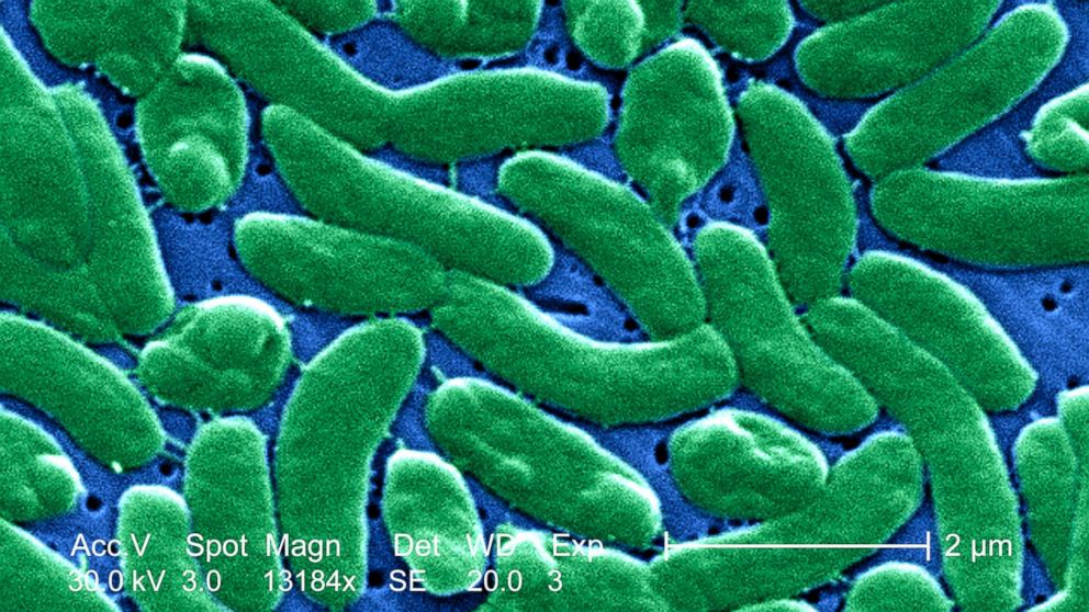 Deadly Bacteria In Florida Beaches Deadly Bacteria In Florida Beaches