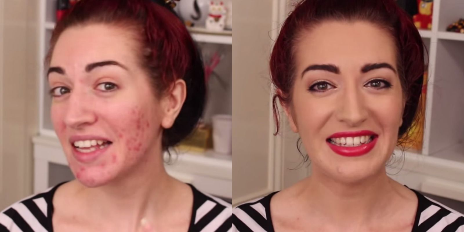 makeup to cover acne scars