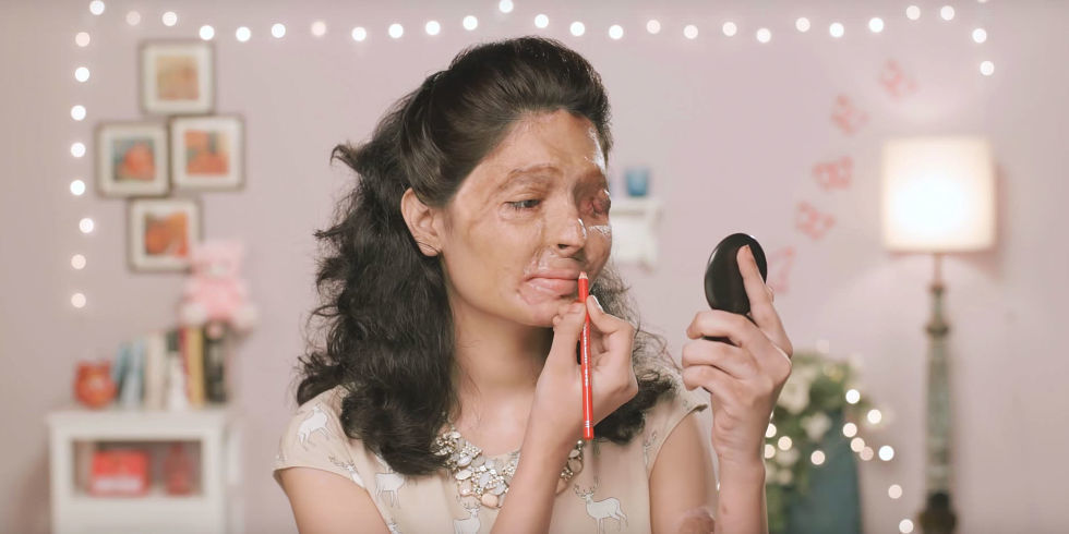 Sharing the story of Reshma, who in 2014 was allegedly the victim of and acid-attack. Her brother-in-law threw sulfuric acid on her face while she was visiting Northern India to take an exam. Sharing the story of Reshma, who in 2014 was allegedly the victim of and acid-attack. Her brother-in-law threw sulfuric acid on her face while she was visiting Northern India to take an exam.