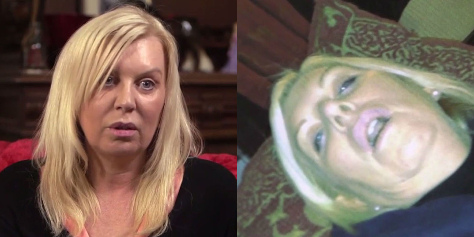 Woman's Botched Eyelid Lift Surgery Goes Horribly Wrong - Plastic