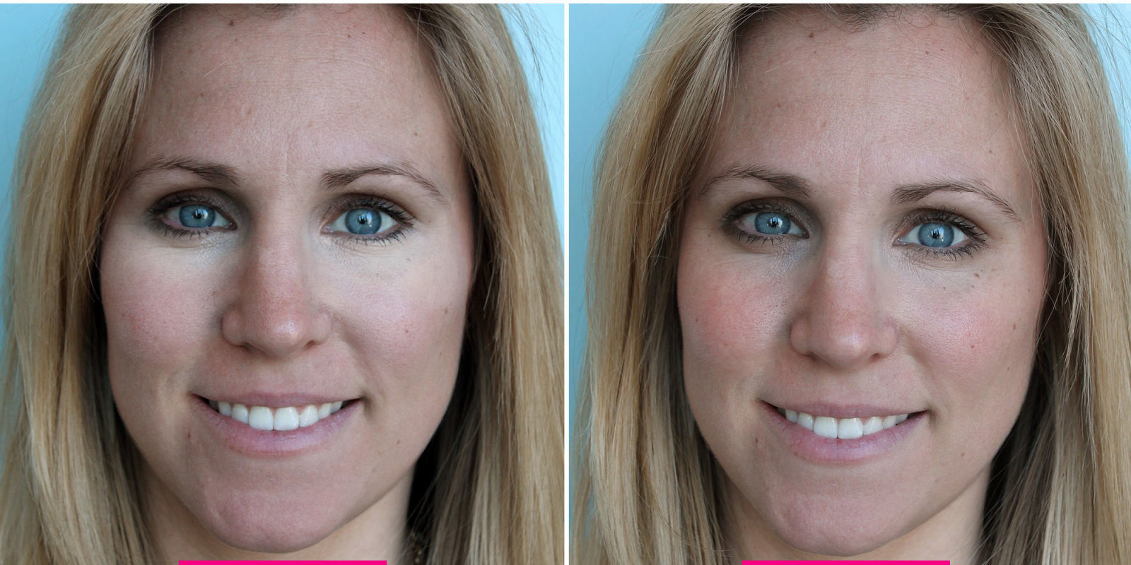 The Under Eye Concealer Trick That