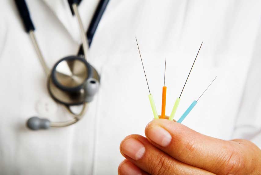 Acupuncture Pain Relief Acupuncture Treatment